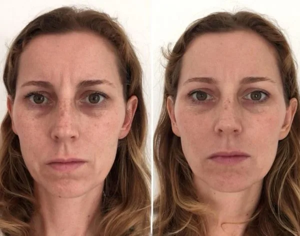 Testimonio real de una alumna del curso de yoga facial