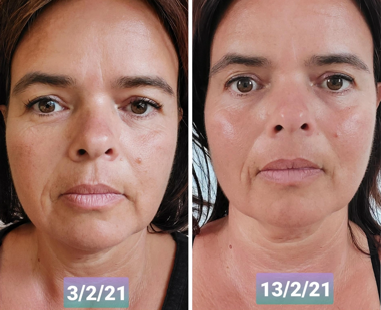 Testimonio real de una alumna del curso de yoga facial