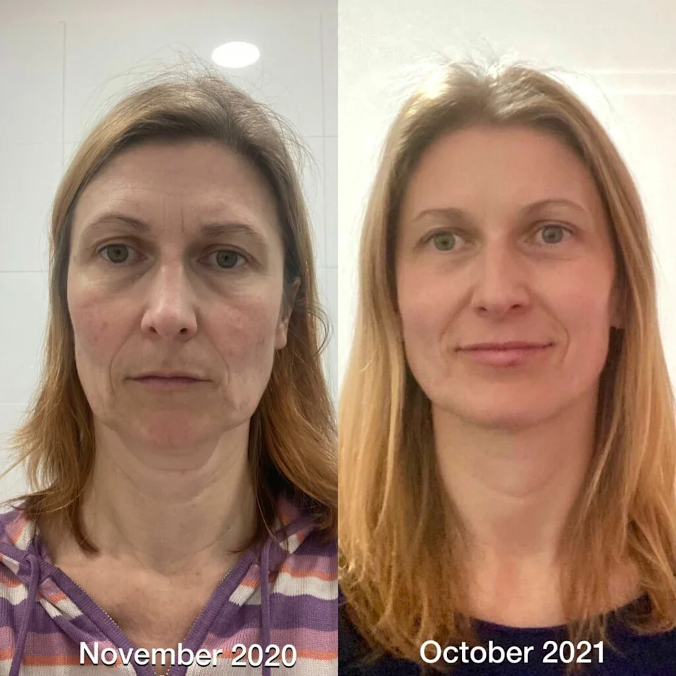 Testimonio real de una alumna del curso de yoga facial