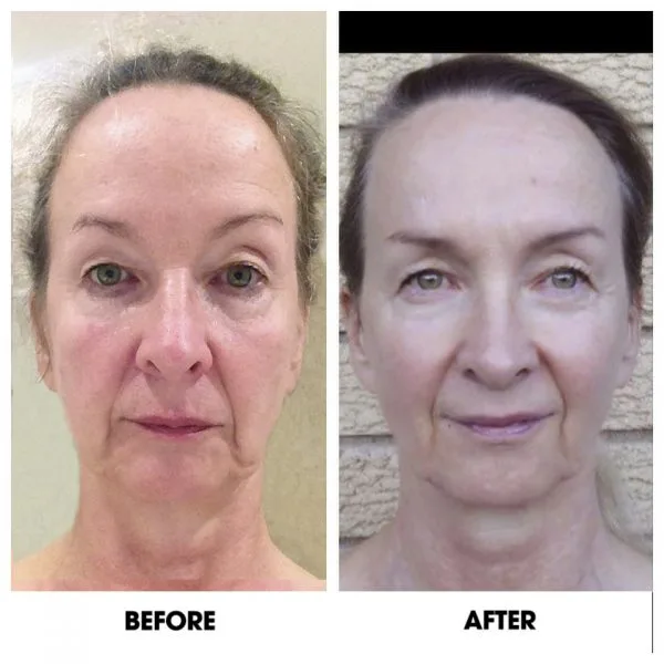 Testimonio real de una alumna del curso de yoga facial